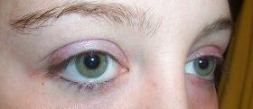 Tatsuya Tatsuya's Eyes